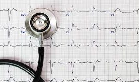 Divisi Jantung dan Pembuluh Darah Aritmia