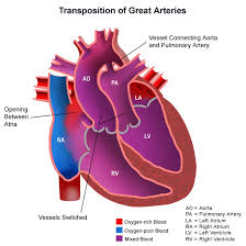 Divisi Jantung dan Pembuluh Darah Kardiologi Pediatrik dan Penyakit Jantung Bawaan